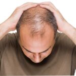 Lose Hair