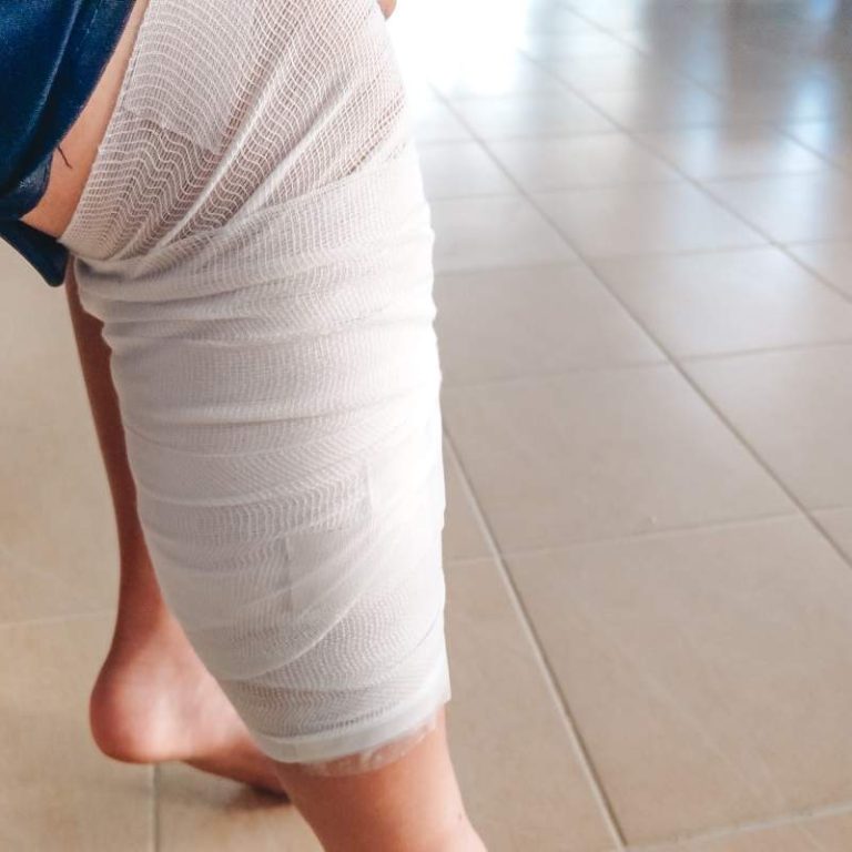 Bandage Bike Accident Scratches On Leg Indian